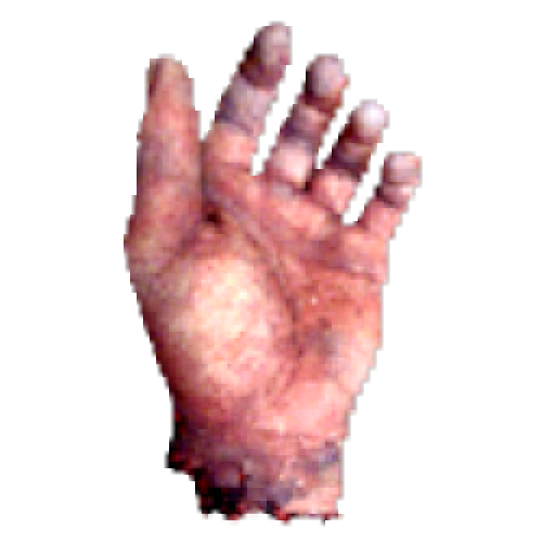 Hand